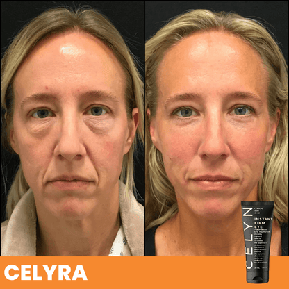 Celyra™ - Crema istantanea per occhiaie e rughe